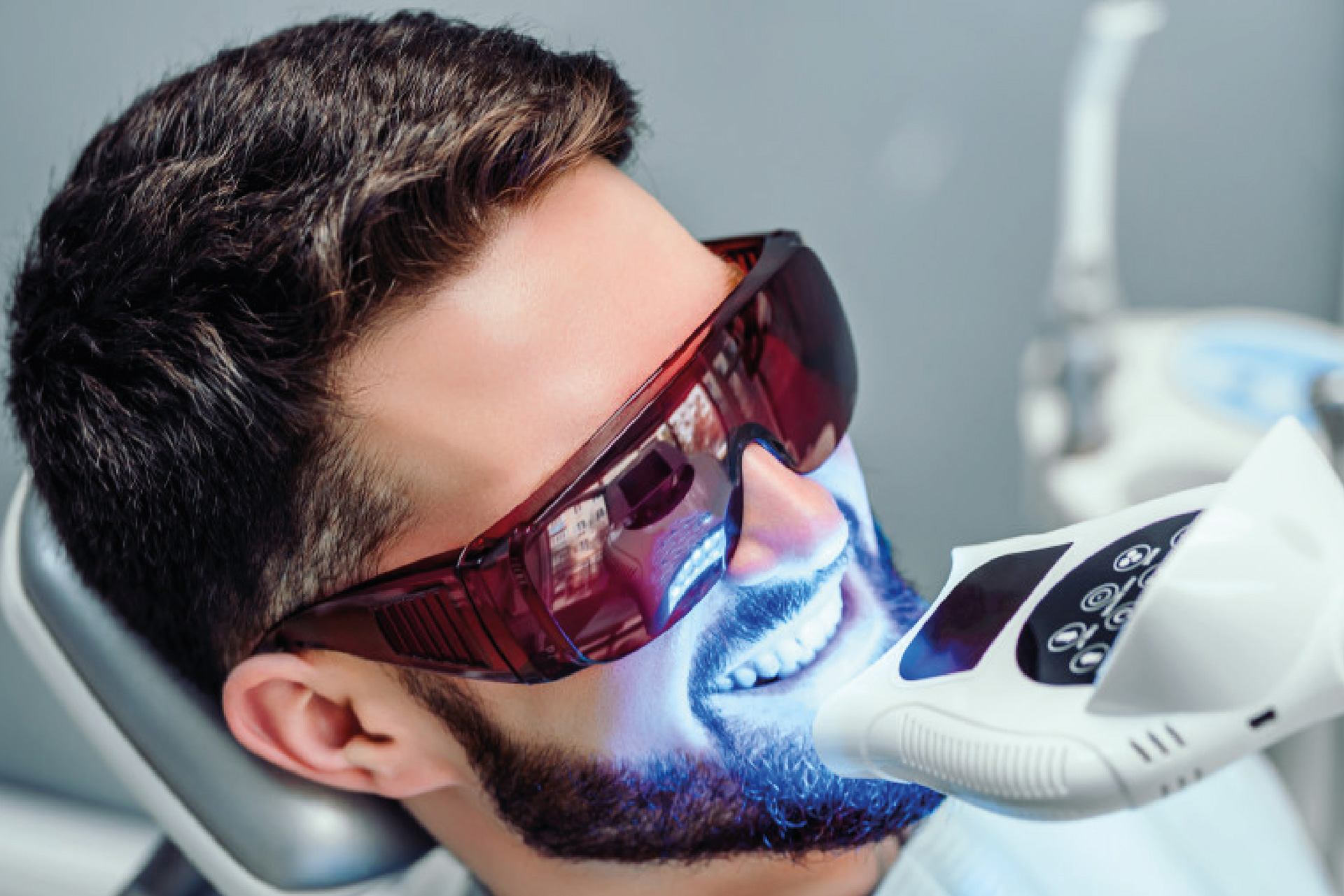 Estetica Dentale Sbiancamento