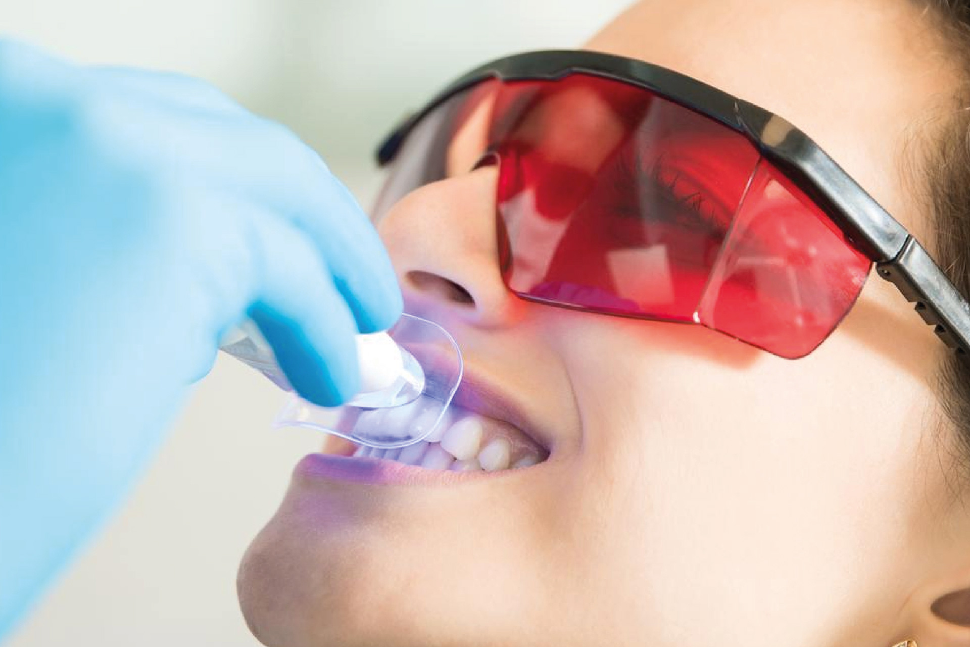 Laser Dentale